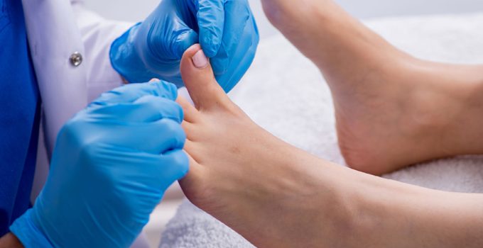 5 things to know about diabetes and foot wounds