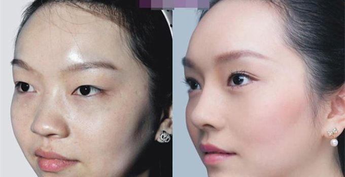 The Single Most Effective Way to Prepare for AB Plastic Surgery in Korea