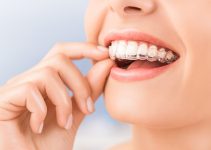 Discover Your Dream Smile with Invisalign at Discovery Dental