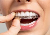 Invisalign: Unlocking the Smile of Your Dreams at West Side Dental Center