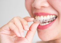 Invisalign: Your Path to the Smile of Your Dreams at V Smile Family Dental